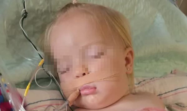 15個月女童被響尾蛇攻擊2次　腳嚴重發黑「注射30瓶血清」救命。（圖／翻攝自募款網站GoFundMe）